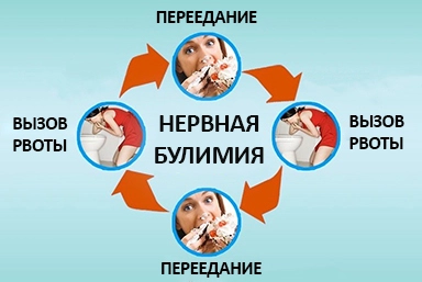 Лечение булимии в Карабаново